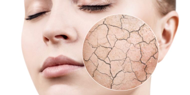 جفاف الجلد: الأسباب الشائعة وطرق التعامل الصحيحة